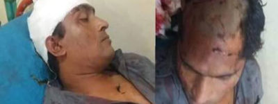 পেশাগত দায়িত্ব পালনের সময় বাঁশখালীতে দৈনিক আলোকিত সকাল পত্রিকার প্রতিনিধি এরশাদের উপর সন্ত্রাসী হামলা.