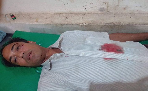 বাঁশখালী শিলকুপে মহিলা মেম্বারের হামলায় পুরুষ মেম্বার হাসপাতালে